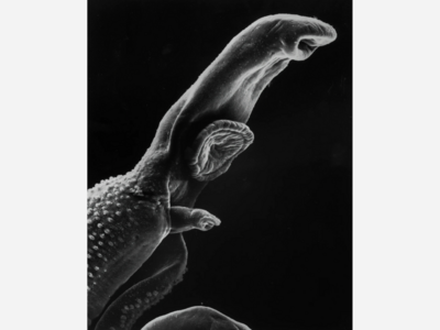  Feeling Unwell? You Could Have a Parasite Living in Your Gut.