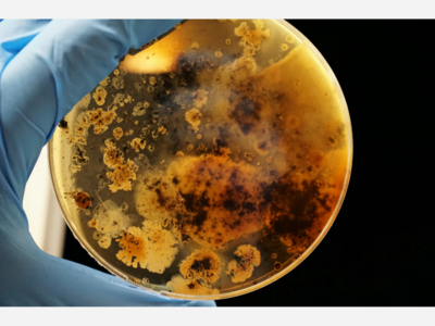A Deadly Fungus Is Spreading Throughout The United States
